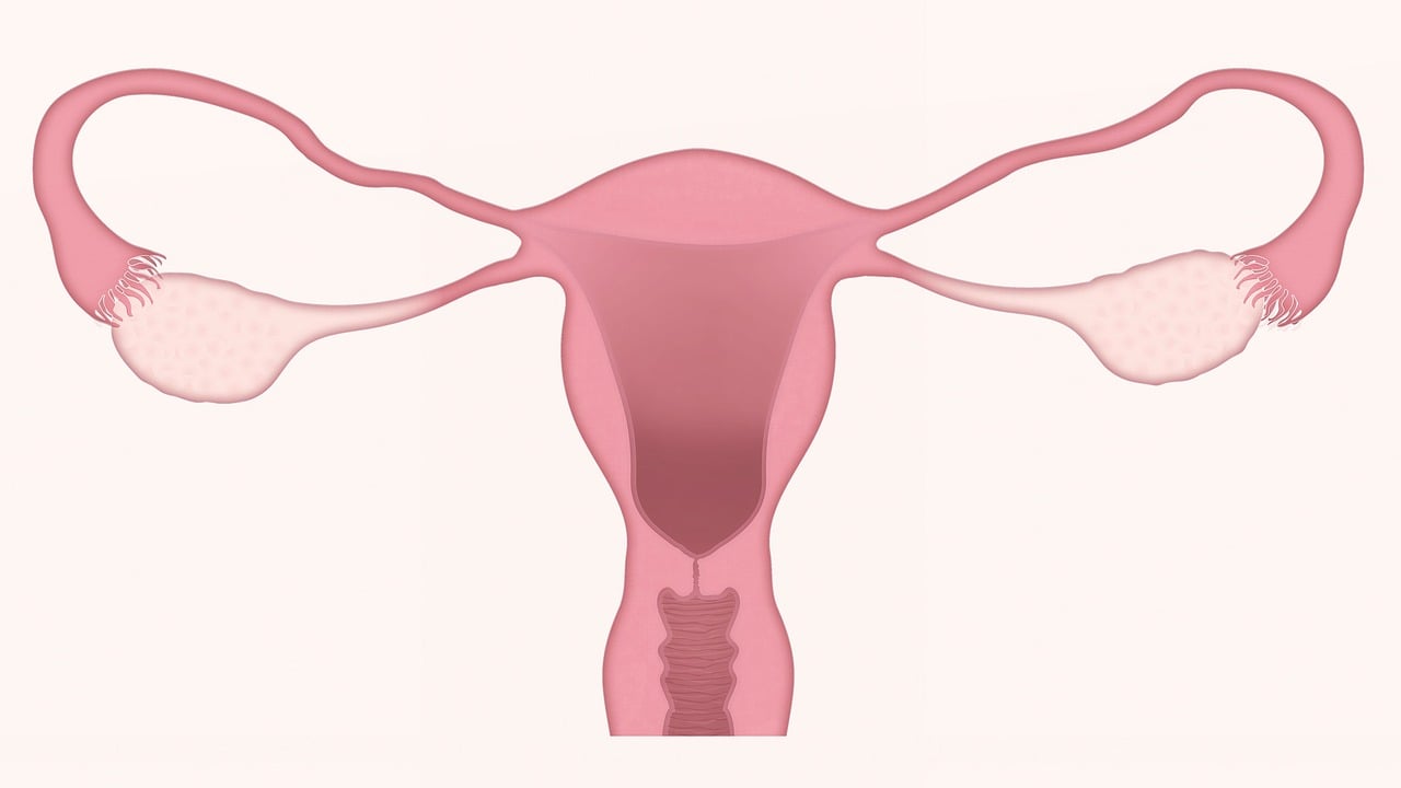 Endometrioza jelit / leczenie endometriozy i operacje endometriozy